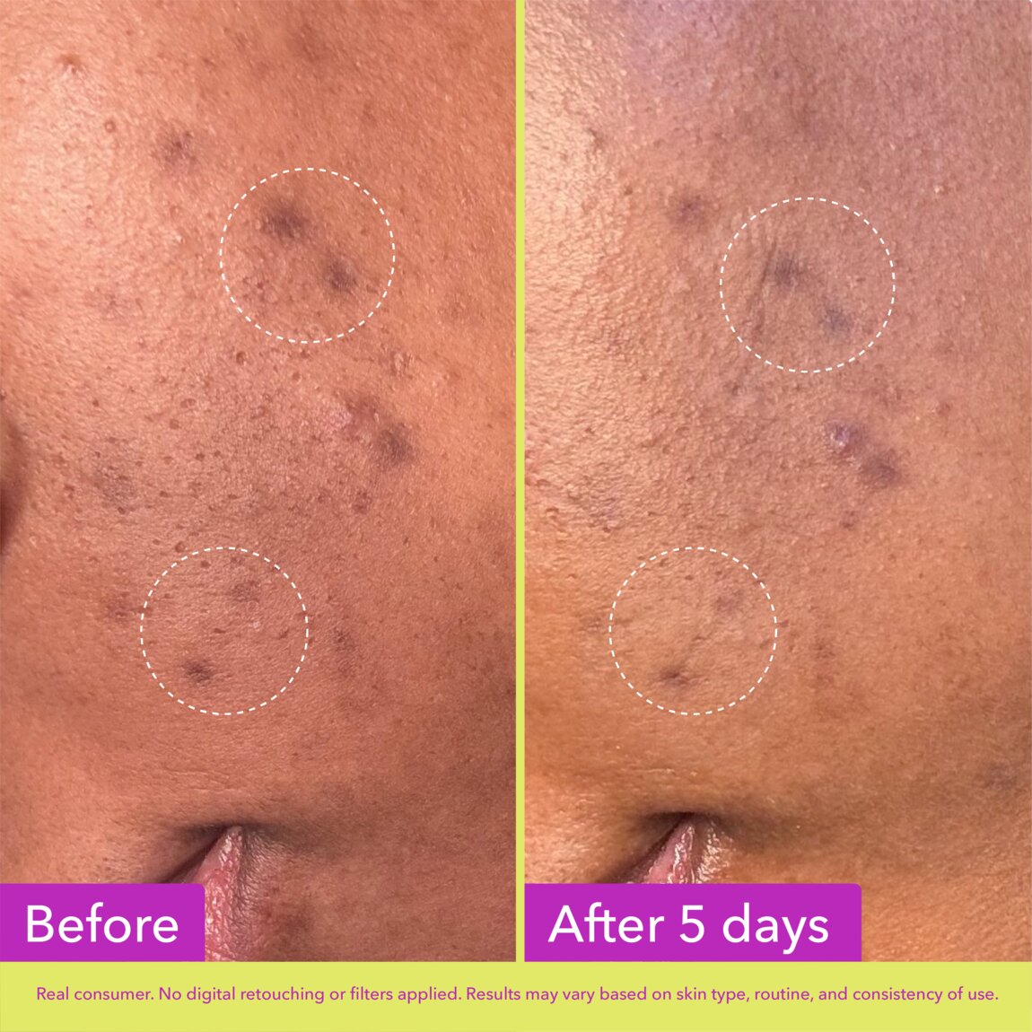 Good Molecules Dark Spot Microdart Patches 24 Patches alternative view 3.