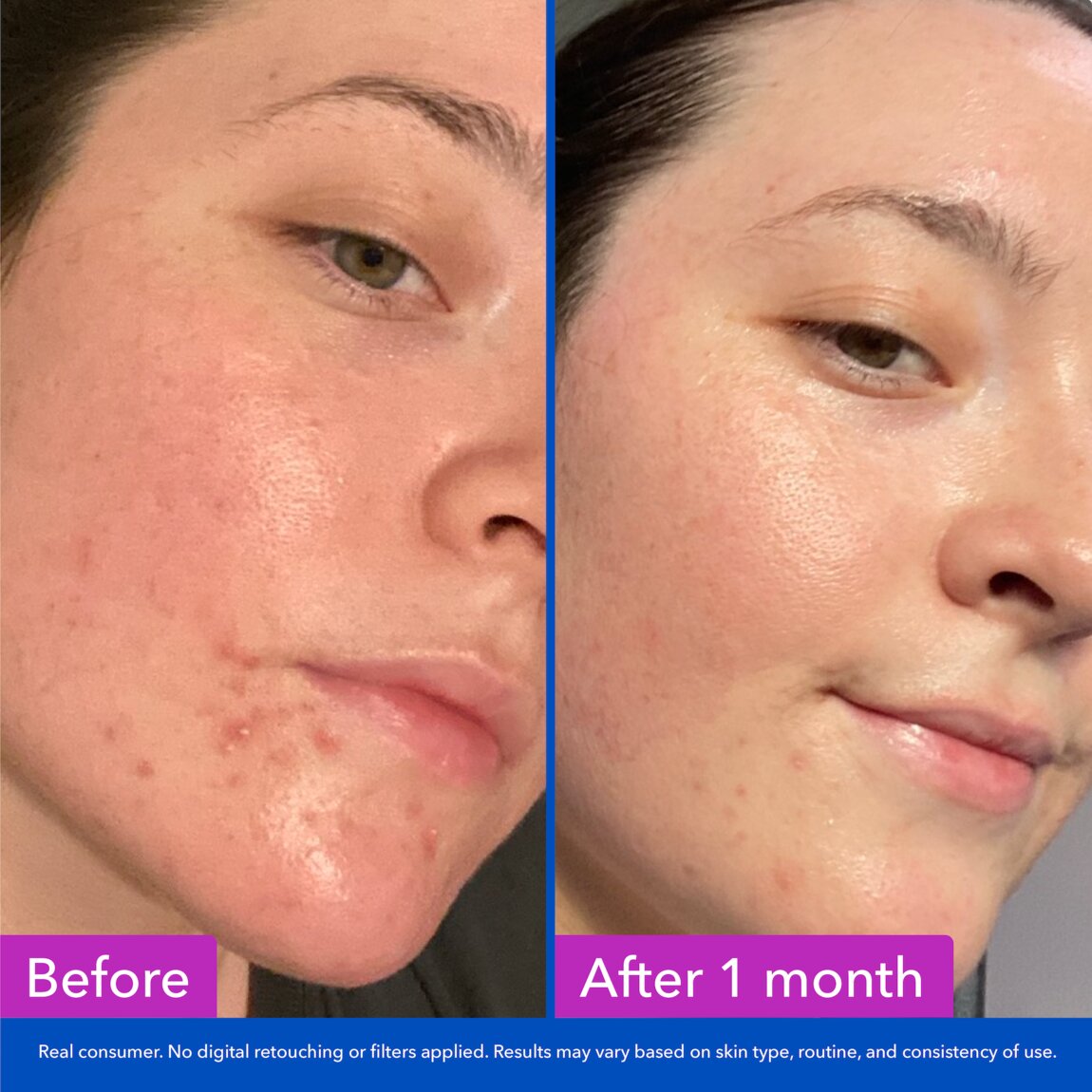 Good Molecules Clarify & Cleanse Bar 1 Bar alternative view 3.
